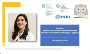 EURO-NMD Neuropathology Webinar Series | Ep 4: Infectious and Neoplastic Neuropathies