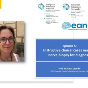 Episode 5 – Clinical Cases Requiring Nerve Biopsy