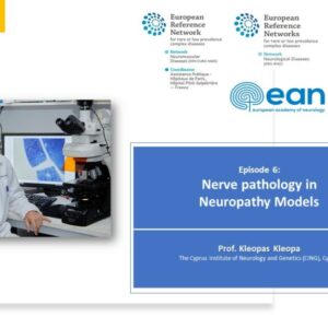 Episode 6 – Nerve Pathology in Neuropathy Models