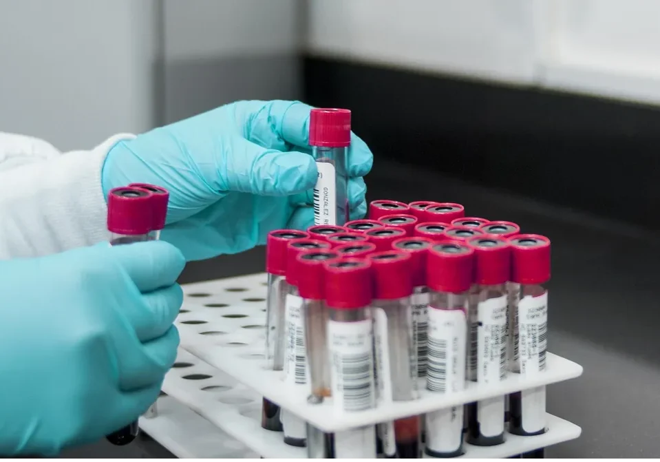 research vials samples stock image